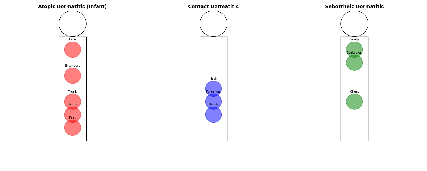 Comparative distribution of eczema subtypes